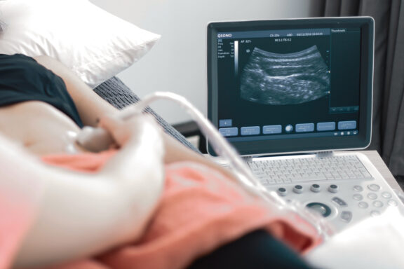 Article content image